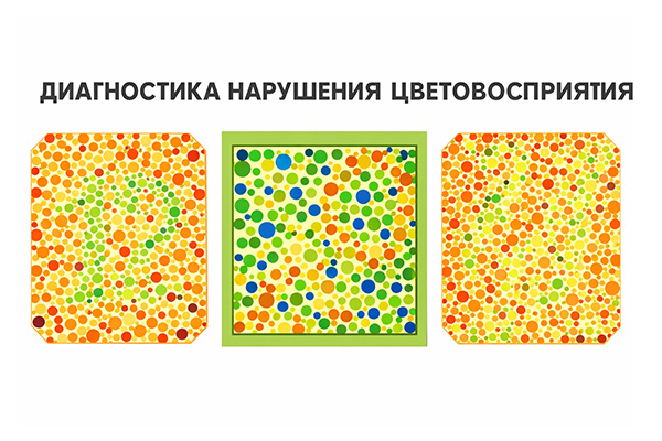 Диагностика нарушения цветовосприятия